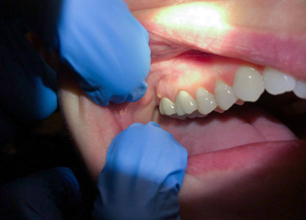 Best Same-Day Emergency Dental Services in Perry, LA