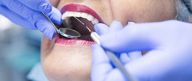 Best Emergency Wisdom Teeth Removal in Perry, LA